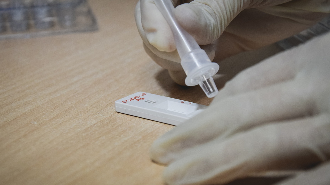На Ставрополье провели более 1,6 миллиона тестов на коронавирус