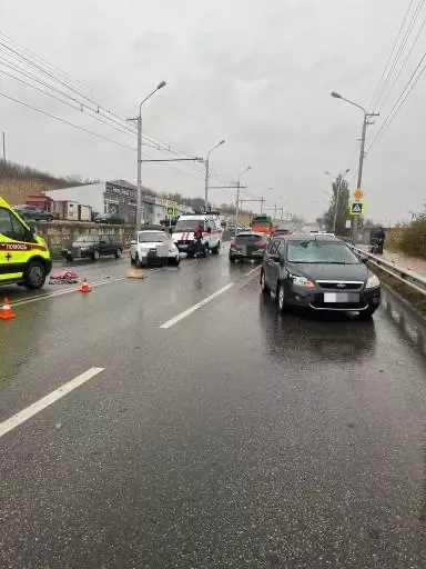 Подросток попал в больницу после наезда автомобиля в Ставрополе